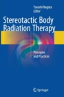 Image for Stereotactic Body Radiation Therapy