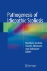 Image for Pathogenesis of Idiopathic Scoliosis