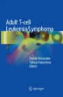 Image for Adult T-cell Leukemia/Lymphoma