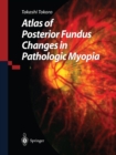 Image for Atlas of Posterior Fundus Changes in Pathologic Myopia