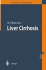 Image for Liver Cirrhosis