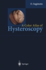 Image for Color Atlas of Hysteroscopy