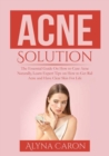 Image for Acne Solution : The Essential Guide On How to Cure Acne Naturally, Learn Expert Tips on How to Get Rid Acne and Have Clear Skin For Life
