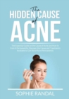 Image for The Hidden Cause of Acne : The Essential Guide on the Cause of Acne and How to Cure it Permanently, Discover the Cause and Treatments Available to Get Rid of Acne Permanently