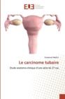 Image for Le carcinome tubaire
