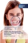 Image for Tooth size discrepancies between Class I &amp; Class II in Davangere