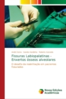 Image for Fissuras Labiopalatinas - Enxertos osseos alveolares