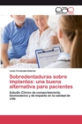 Image for Sobredentaduras sobre implantes : una buena alternativa para pacientes