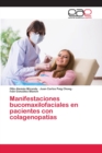 Image for Manifestaciones bucomaxilofaciales en pacientes con colagenopatias