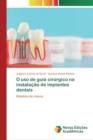 Image for O uso de guia cirurgico na instalacao de implantes dentais