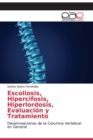 Image for Escoliosis, Hipercifosis, Hiperlordosis, Evaluacion y Tratamiento