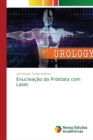 Image for Enucleacao da Prostata com Laser