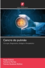 Image for Cancro do pulmao