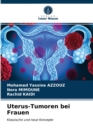 Image for Uterus-Tumoren bei Frauen