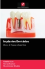 Image for Implantes Dentarios