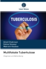 Image for Multifokale Tuberkulose