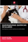 Image for Queimaduras Quimicas Oculares