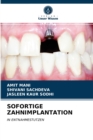 Image for Sofortige Zahnimplantation