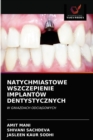 Image for Natychmiastowe Wszczepienie Implantow Dentystycznych