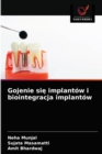 Image for Gojenie sie implantow i biointegracja implantow