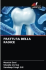 Image for Frattura Della Radice