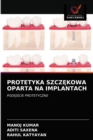 Image for Protetyka SzczEkowa Oparta Na Implantach