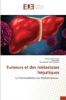 Image for Tumeurs et des metastases hepatiques
