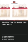 Image for Protocole de Pose Des Implants