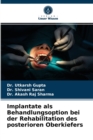 Image for Implantate als Behandlungsoption bei der Rehabilitation des posterioren Oberkiefers