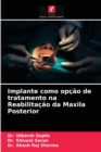 Image for Implante como opcao de tratamento na Reabilitacao da Maxila Posterior