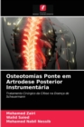 Image for Osteotomias Ponte em Artrodese Posterior Instrumentaria