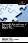 Image for Traumatic Bucket Loop of the Medial Meniscus on Stable Knee
