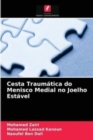 Image for Cesta Traumatica do Menisco Medial no Joelho Estavel
