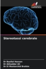 Image for Stereotassi cerebrale