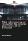Image for Aides radiologiques pour l&#39;evaluation des maladies parodontales et leur traitement