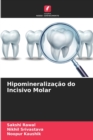 Image for Hipomineralizacao do Incisivo Molar