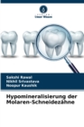 Image for Hypomineralisierung der Molaren-Schneidezahne