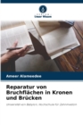 Image for Reparatur von Bruchflachen in Kronen und Brucken