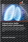 Image for Conoscenza della tubercolosi polmonare