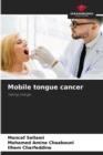 Image for Mobile tongue cancer