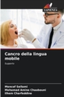 Image for Cancro della lingua mobile