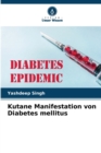 Image for Kutane Manifestation von Diabetes mellitus