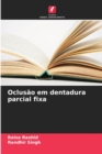 Image for Oclusao em dentadura parcial fixa