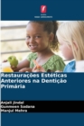 Image for Restauracoes Esteticas Anteriores na Denticao Primaria