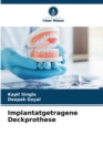 Image for Implantatgetragene Deckprothese