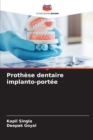 Image for Prothese dentaire implanto-portee