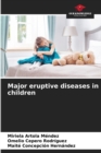Image for Major eruptive diseases in children