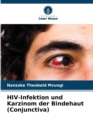 Image for HIV-Infektion und Karzinom der Bindehaut (Conjunctiva)