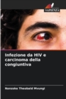Image for Infezione da HIV e carcinoma della congiuntiva