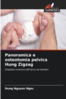 Image for Panoramica e osteotomia pelvica Hung Zigzag